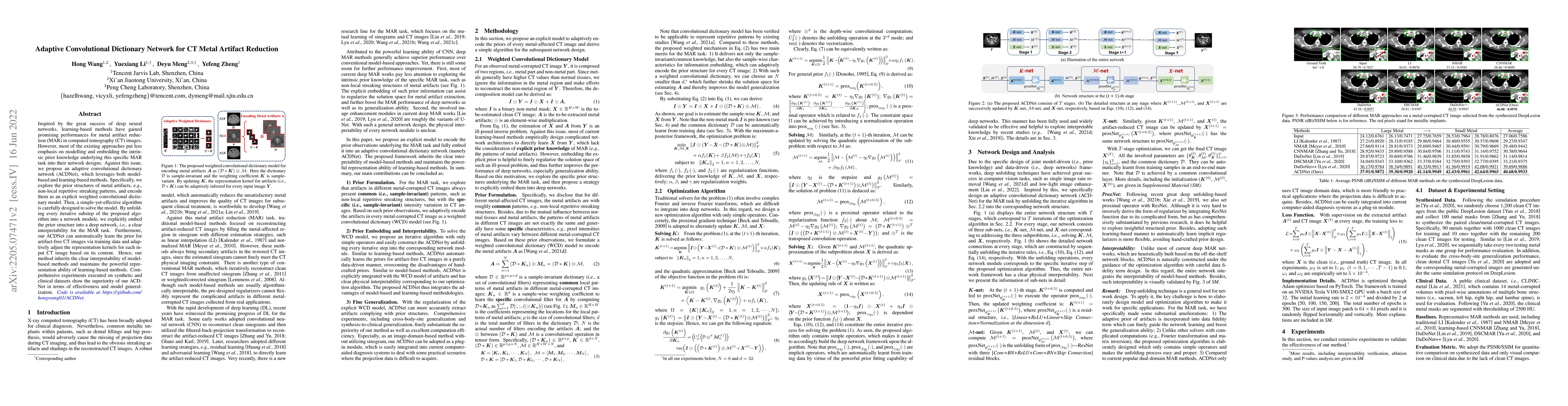 Thumbnail for Adaptive Convolutional Dictionary Network for CT Metal Artifact
  Reduction