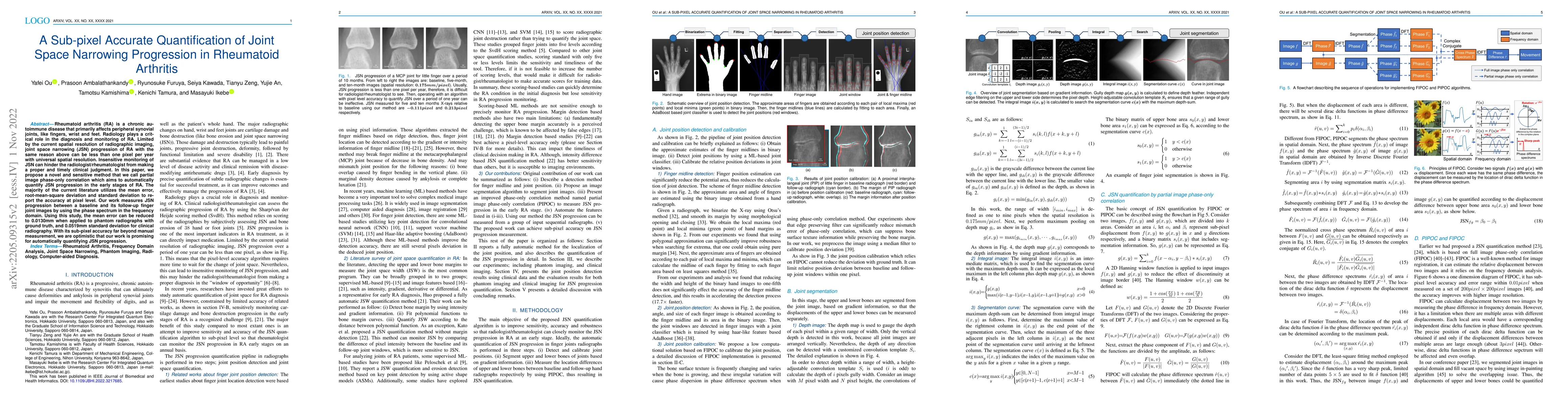 Thumbnail for A Sub-pixel Accurate Quantification of Joint Space Narrowing Progression
  in Rheumatoid Arthritis