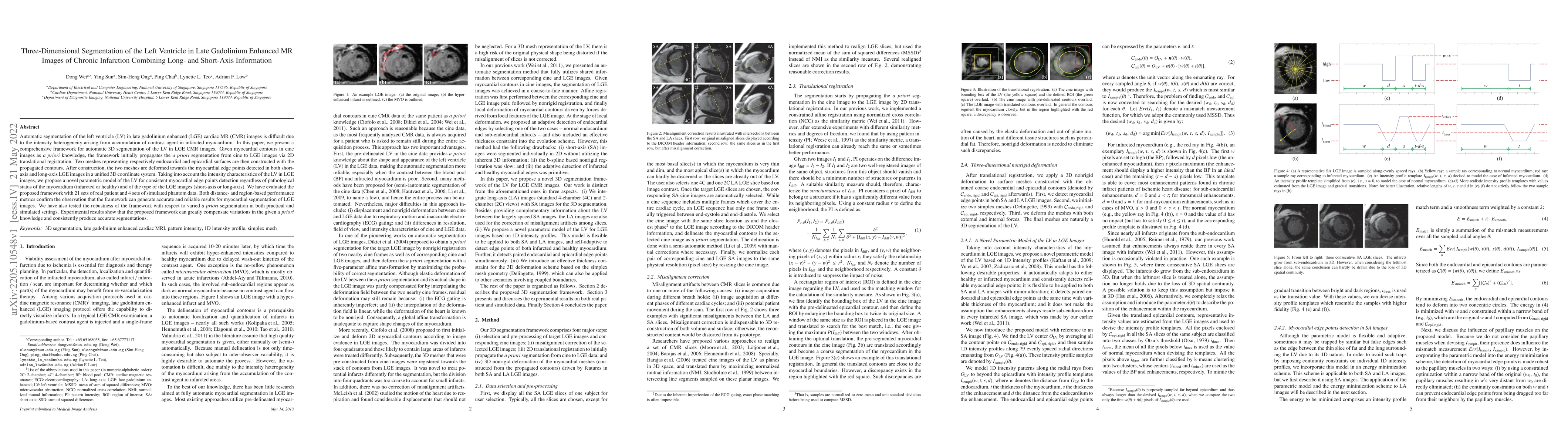 Thumbnail for Three-Dimensional Segmentation of the Left Ventricle in Late Gadolinium
  Enhanced MR Images of Chronic Infarction Combining Long- and Short-Axis
  Information
