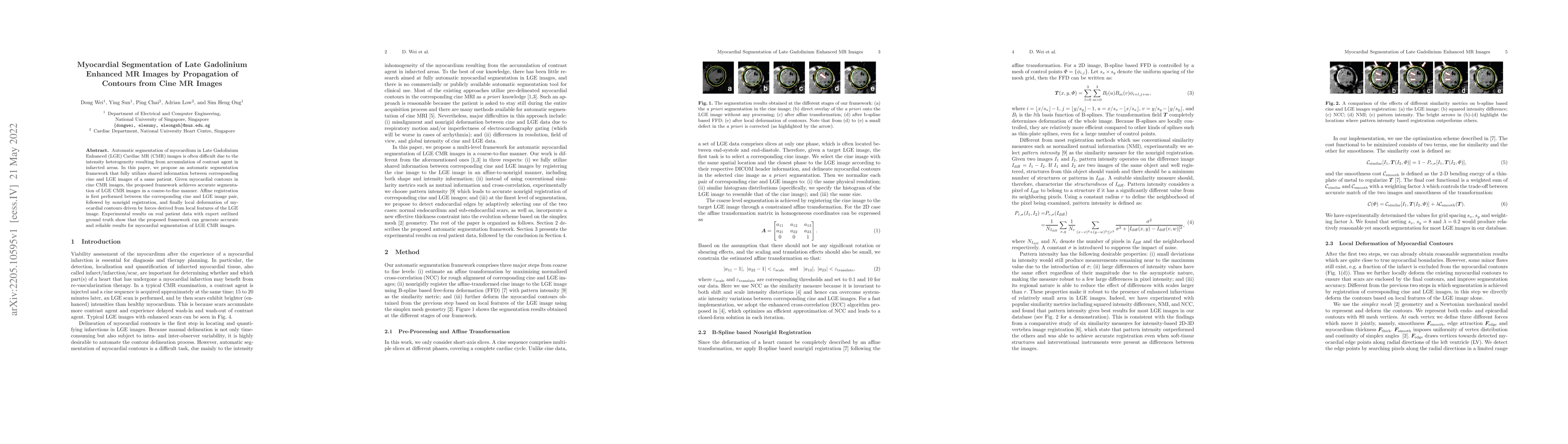 Thumbnail for Myocardial Segmentation of Late Gadolinium Enhanced MR Images by
  Propagation of Contours from Cine MR Images