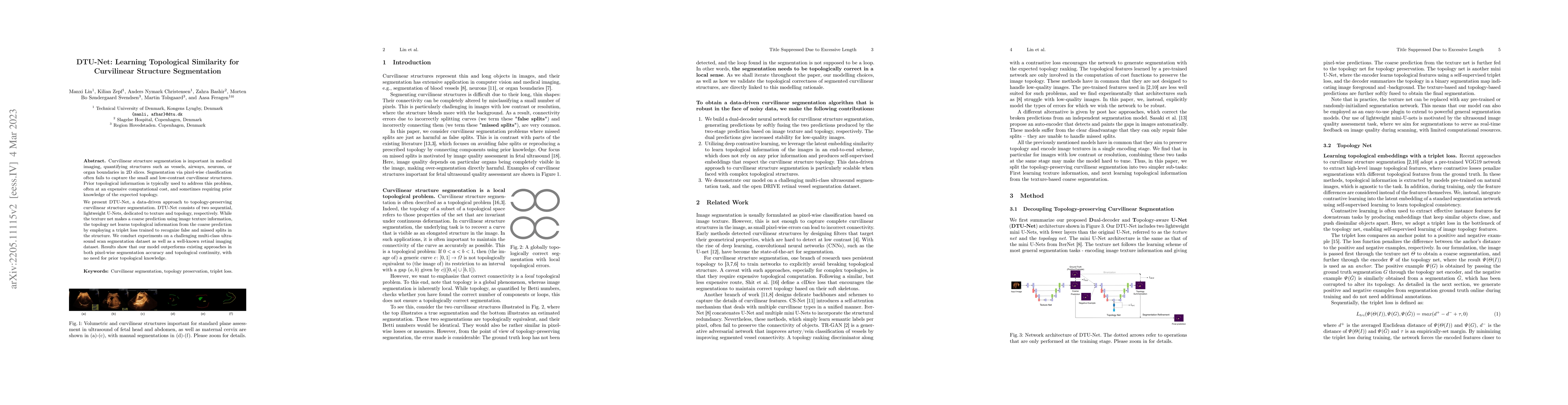 Thumbnail for DTU-Net: Learning Topological Similarity for Curvilinear Structure
  Segmentation