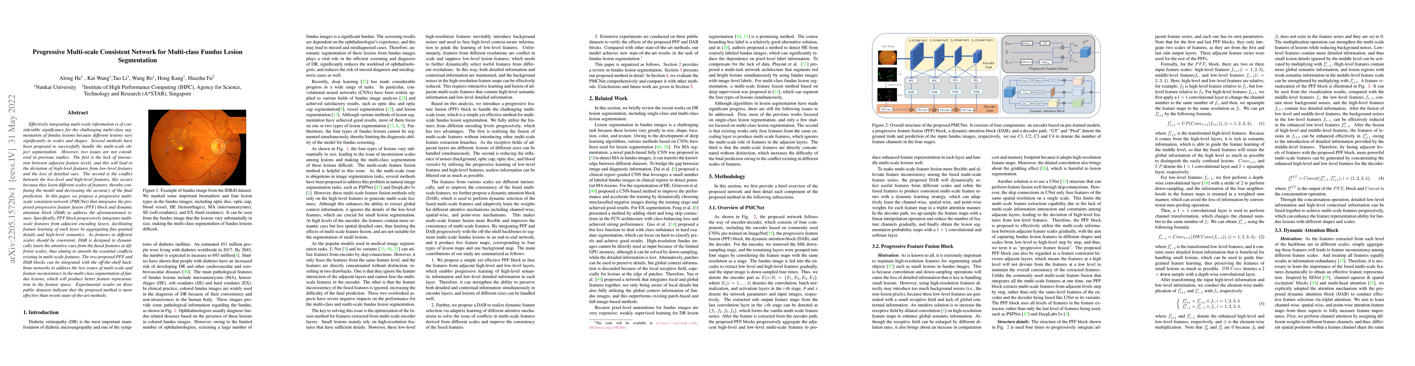 Thumbnail for Progressive Multi-scale Consistent Network for Multi-class Fundus Lesion
  Segmentation