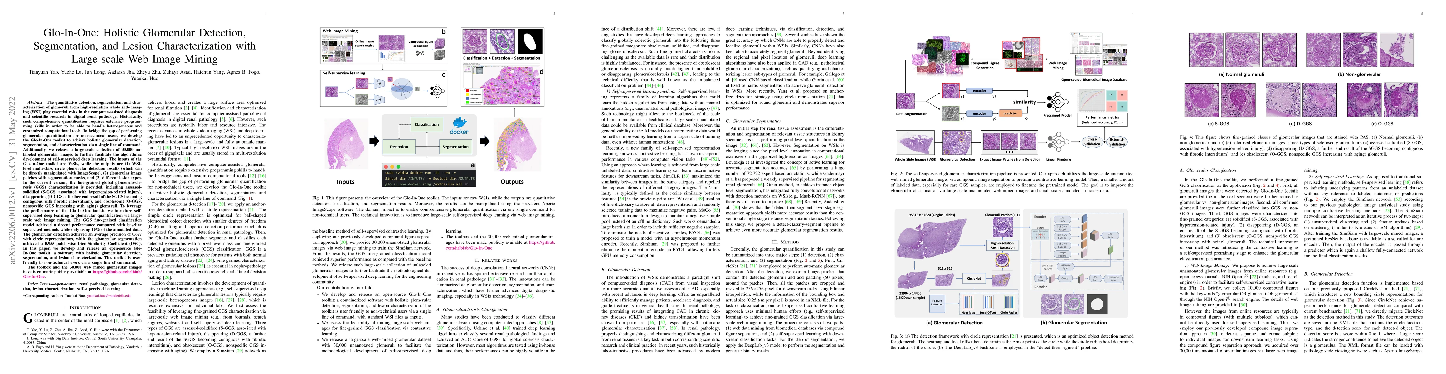 Thumbnail for Glo-In-One: Holistic Glomerular Detection, Segmentation, and Lesion
  Characterization with Large-scale Web Image Mining