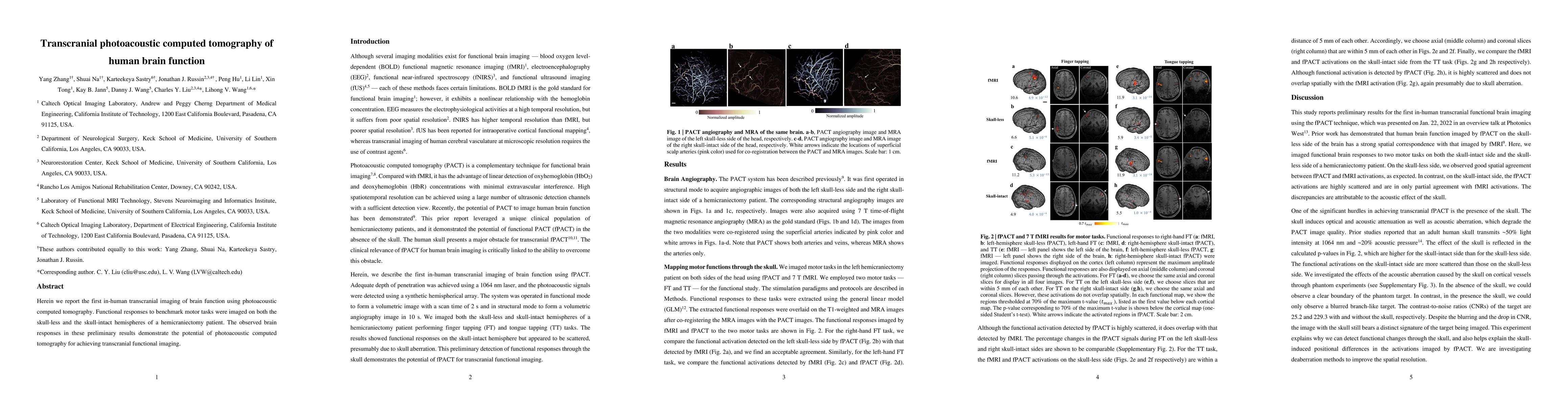 Thumbnail for Transcranial photoacoustic computed tomography of human brain function