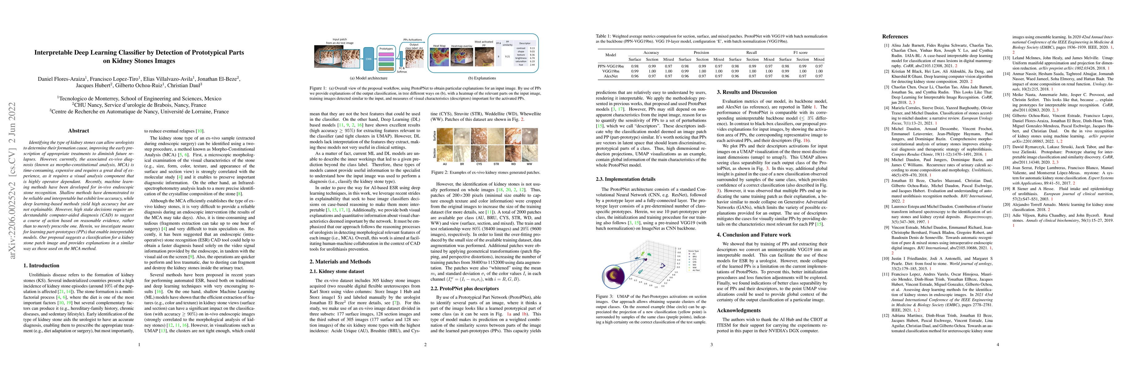 Thumbnail for Interpretable Deep Learning Classifier by Detection of Prototypical
  Parts on Kidney Stones Images