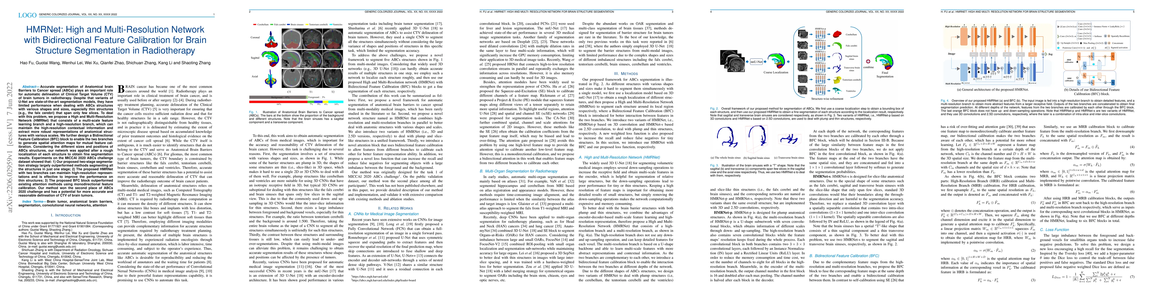 Thumbnail for HMRNet: High and Multi-Resolution Network with Bidirectional Feature
  Calibration for Brain Structure Segmentation in Radiotherapy