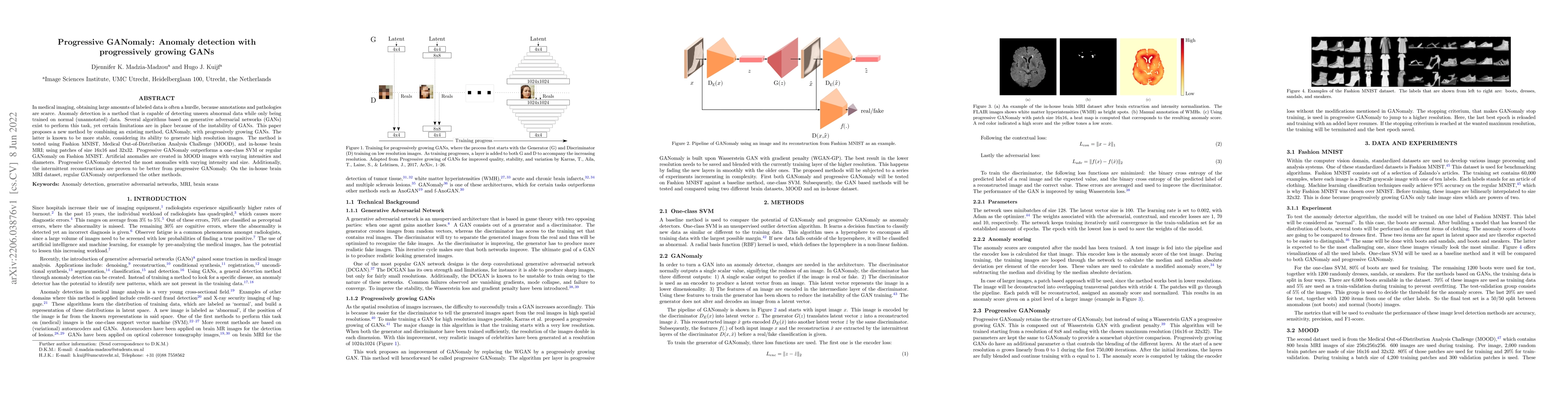 Thumbnail for Progressive GANomaly: Anomaly detection with progressively growing GANs