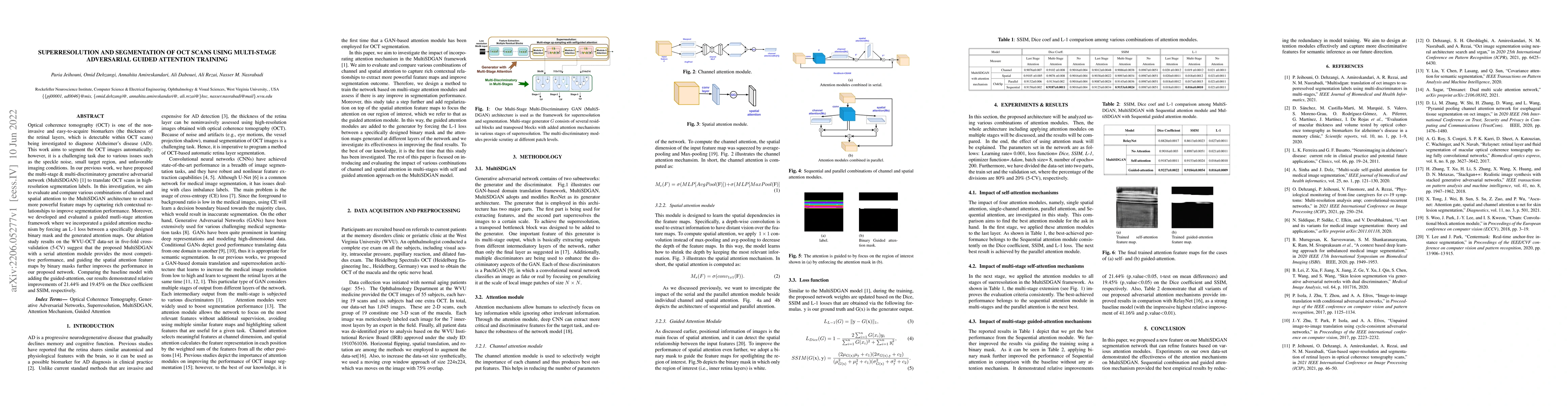 Thumbnail for Superresolution and Segmentation of OCT scans using Multi-Stage
  adversarial Guided Attention Training