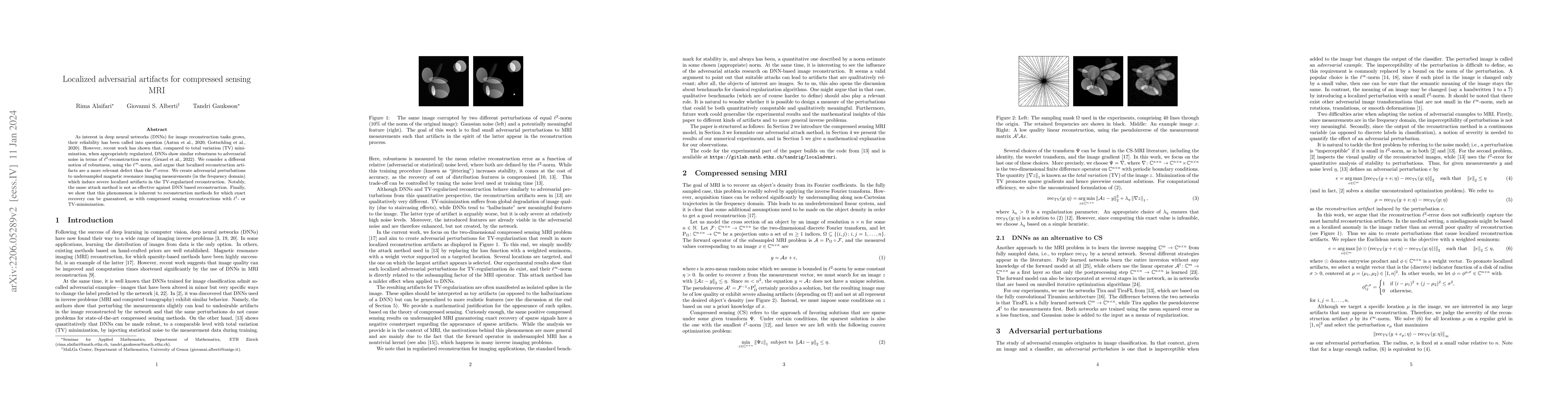 Thumbnail for Localized adversarial artifacts for compressed sensing MRI