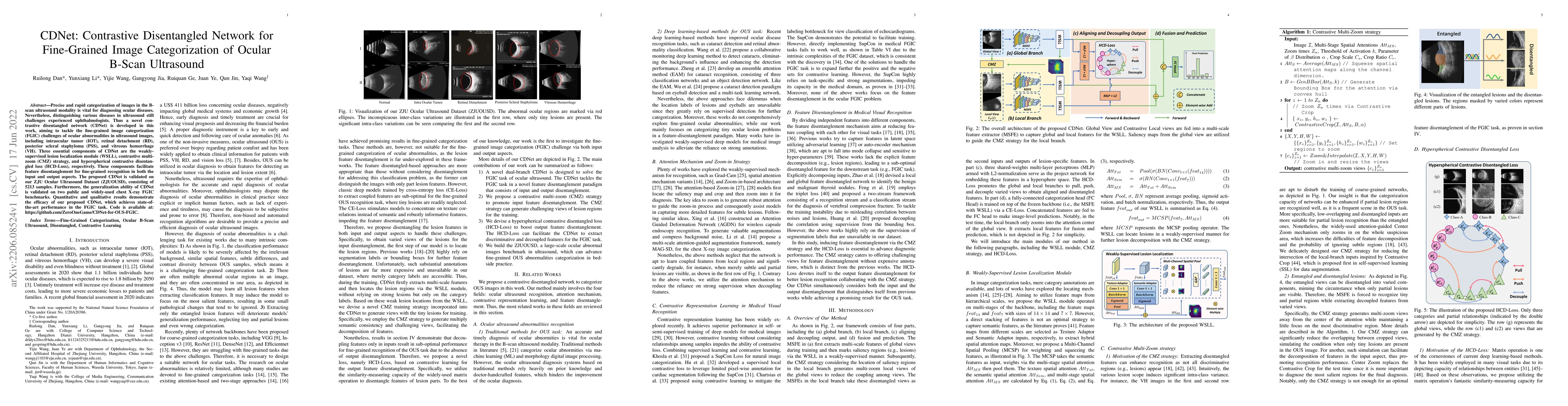 Thumbnail for CDNet: Contrastive Disentangled Network for Fine-Grained Image
  Categorization of Ocular B-Scan Ultrasound
