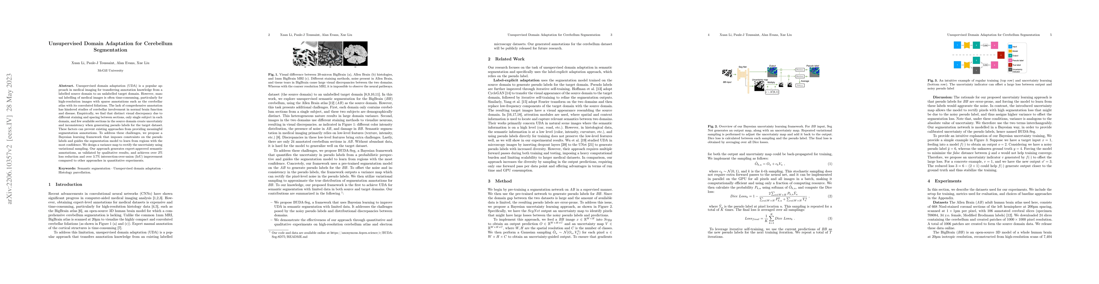 Thumbnail for Confidence-Guided Unsupervised Domain Adaptation for Cerebellum
  Segmentation
