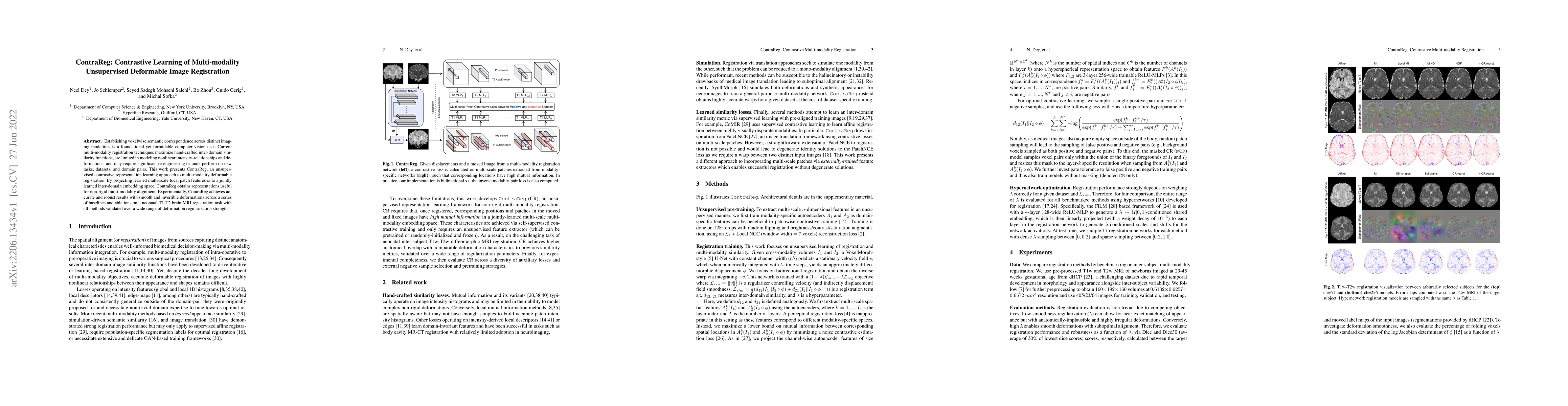 Thumbnail for ContraReg: Contrastive Learning of Multi-modality Unsupervised
  Deformable Image Registration