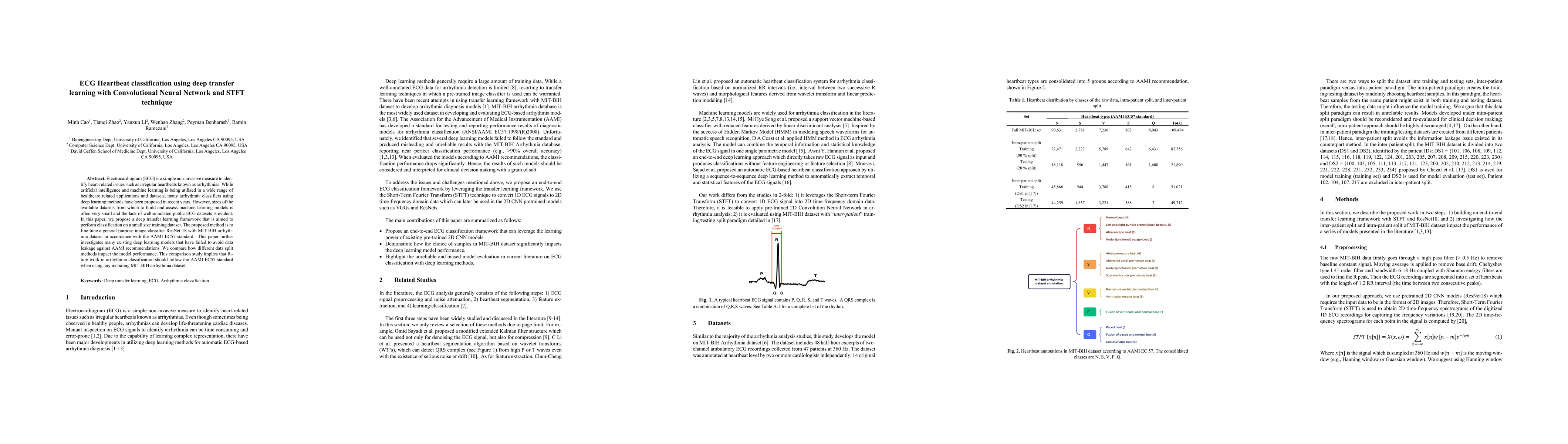 Thumbnail for ECG Heartbeat classification using deep transfer learning with
  Convolutional Neural Network and STFT technique