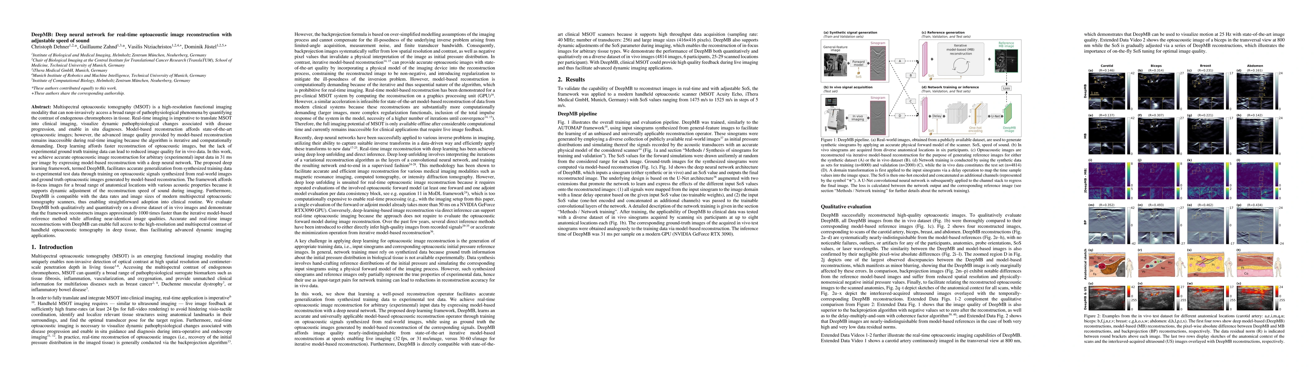 Thumbnail for DeepMB: Deep neural network for real-time optoacoustic image
  reconstruction with adjustable speed of sound