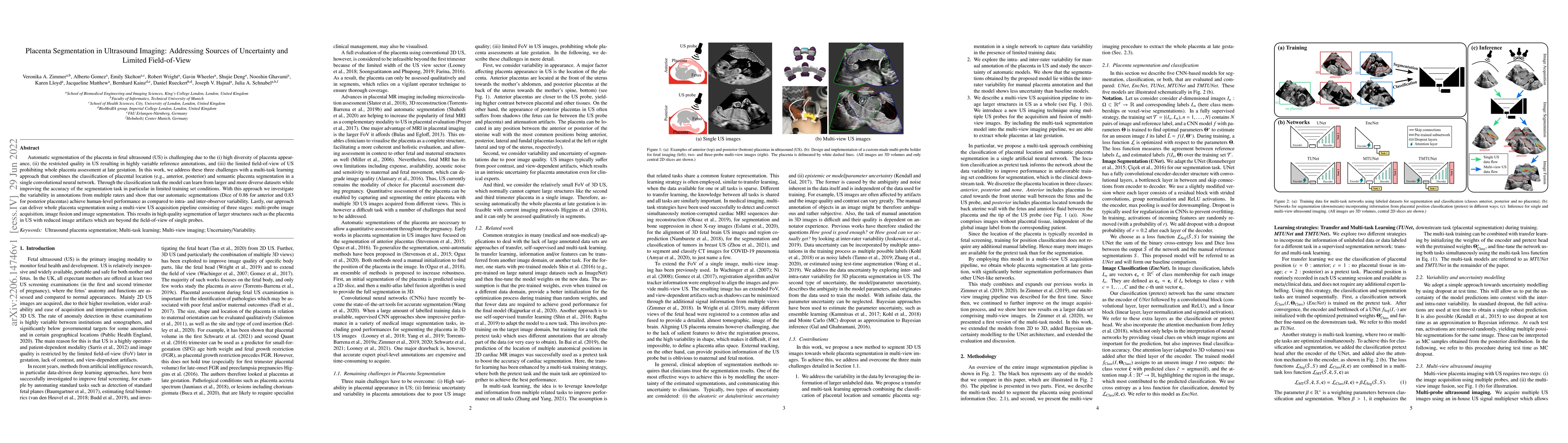 Thumbnail for Placenta Segmentation in Ultrasound Imaging: Addressing Sources of
  Uncertainty and Limited Field-of-View