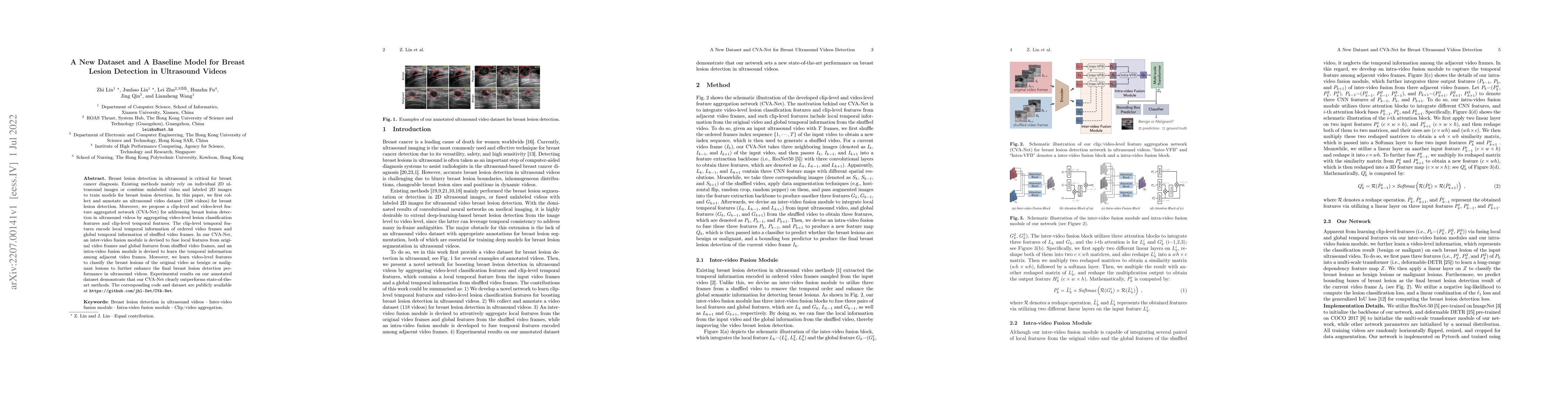 Thumbnail for A New Dataset and A Baseline Model for Breast Lesion Detection in
  Ultrasound Videos