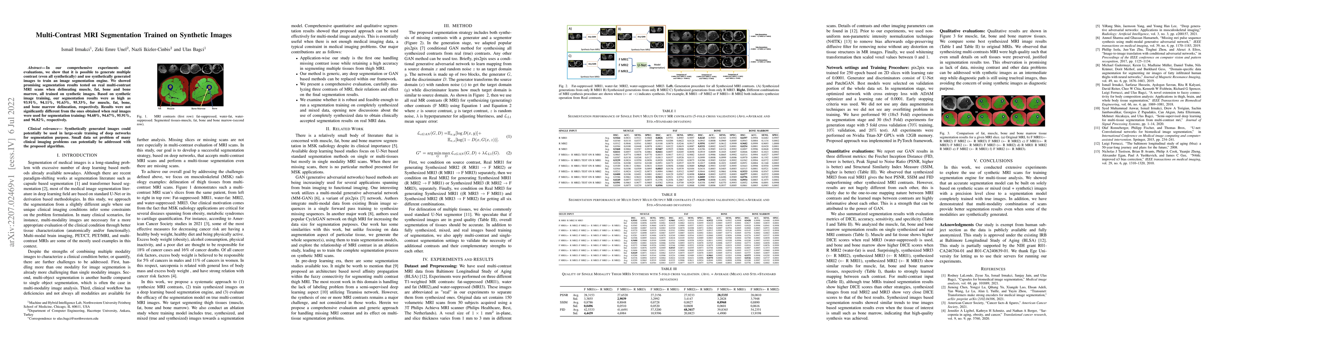 Thumbnail for Multi-Contrast MRI Segmentation Trained on Synthetic Images