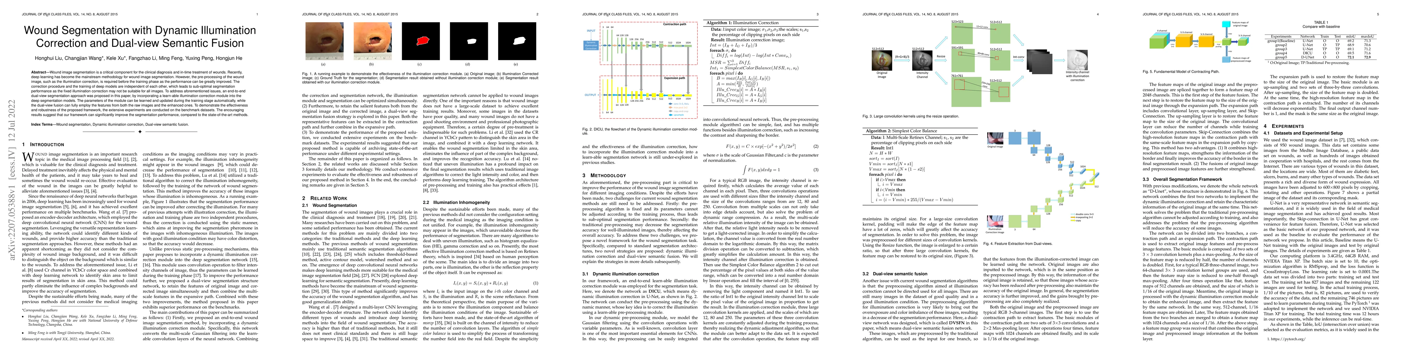 Thumbnail for Wound Segmentation with Dynamic Illumination Correction and Dual-view
  Semantic Fusion