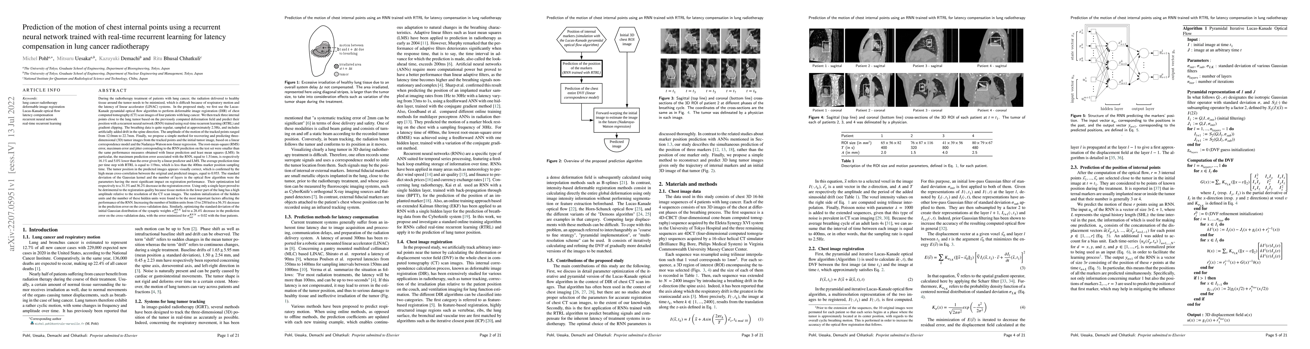 Thumbnail for Prediction of the motion of chest internal points using a recurrent
  neural network trained with real-time recurrent learning for latency
  compensation in lung cancer radiotherapy