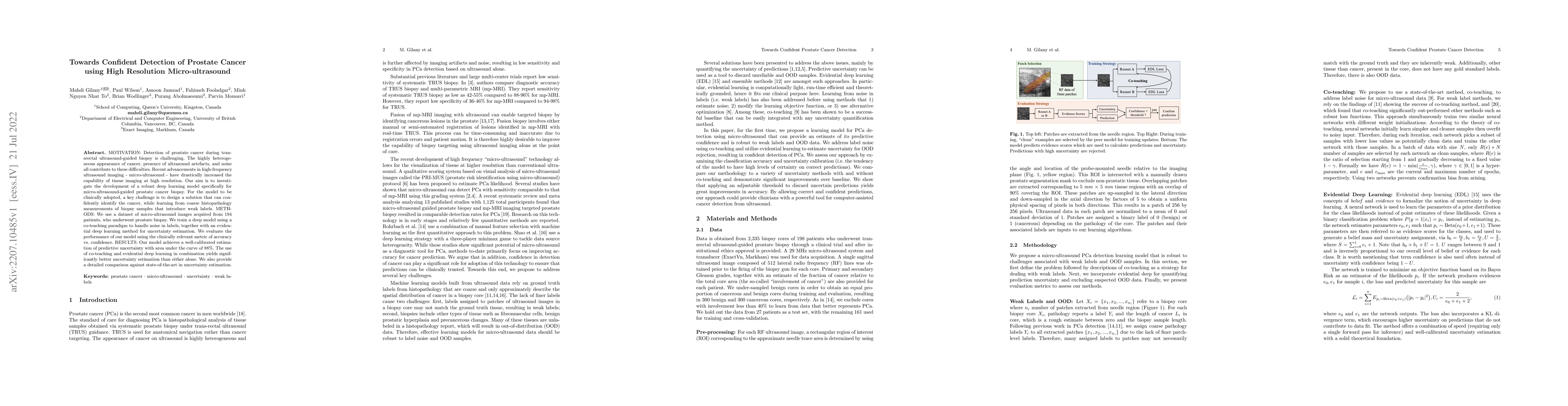 Thumbnail for Towards Confident Detection of Prostate Cancer using High Resolution
  Micro-ultrasound