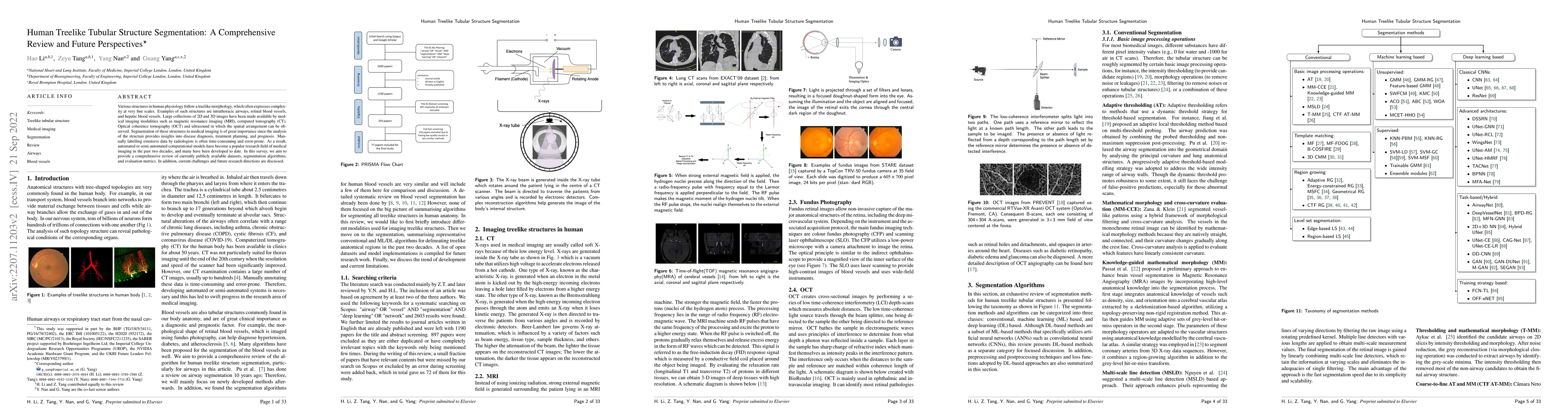 Thumbnail for Human Treelike Tubular Structure Segmentation: A Comprehensive Review
  and Future Perspectives