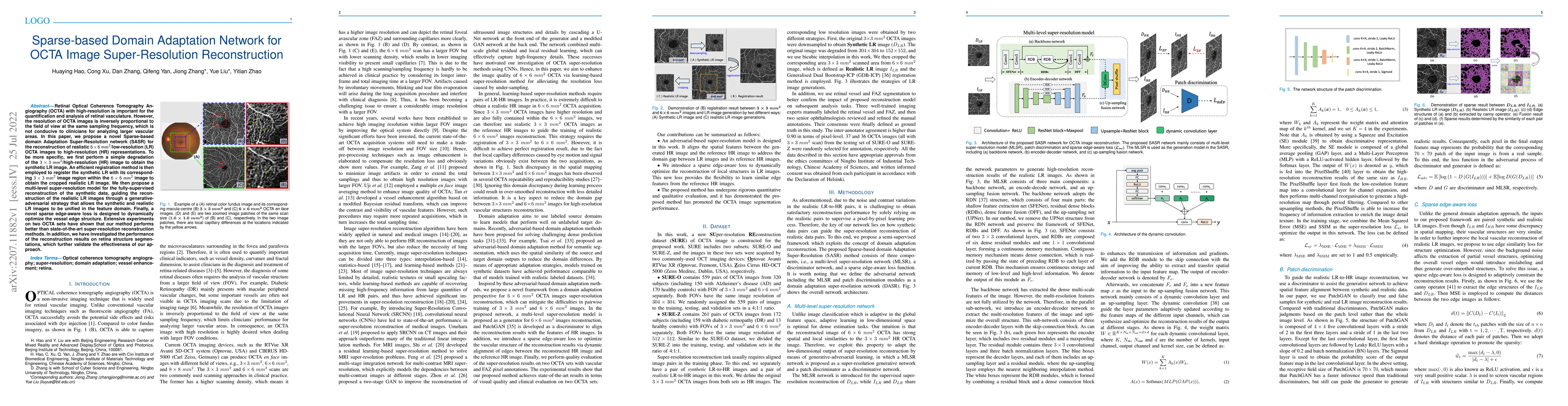 Thumbnail for Sparse-based Domain Adaptation Network for OCTA Image Super-Resolution
  Reconstruction