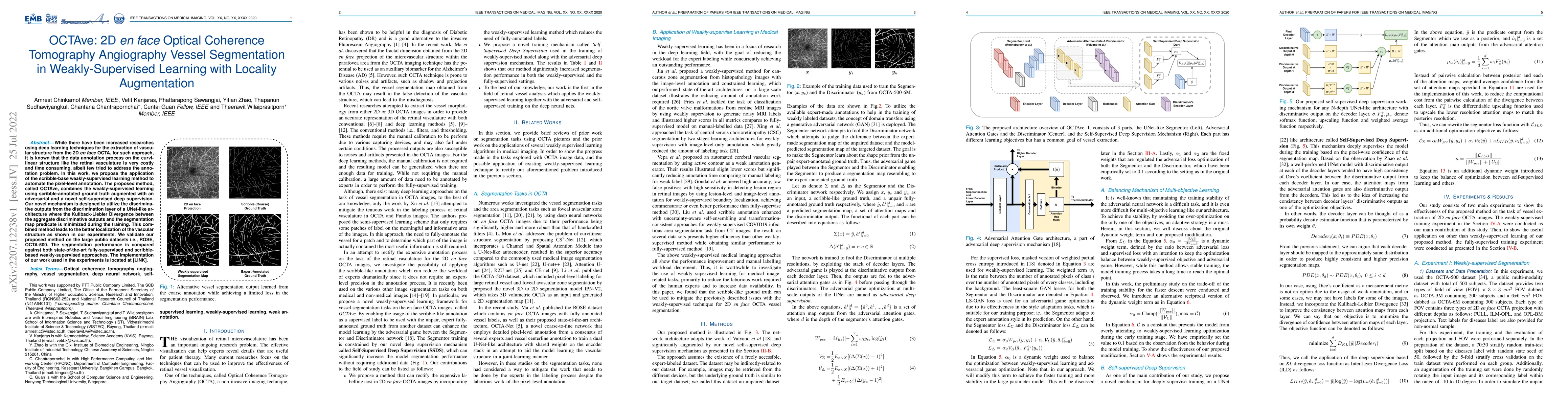 Thumbnail for OCTAve: 2D en face Optical Coherence Tomography Angiography Vessel
  Segmentation in Weakly-Supervised Learning with Locality Augmentation