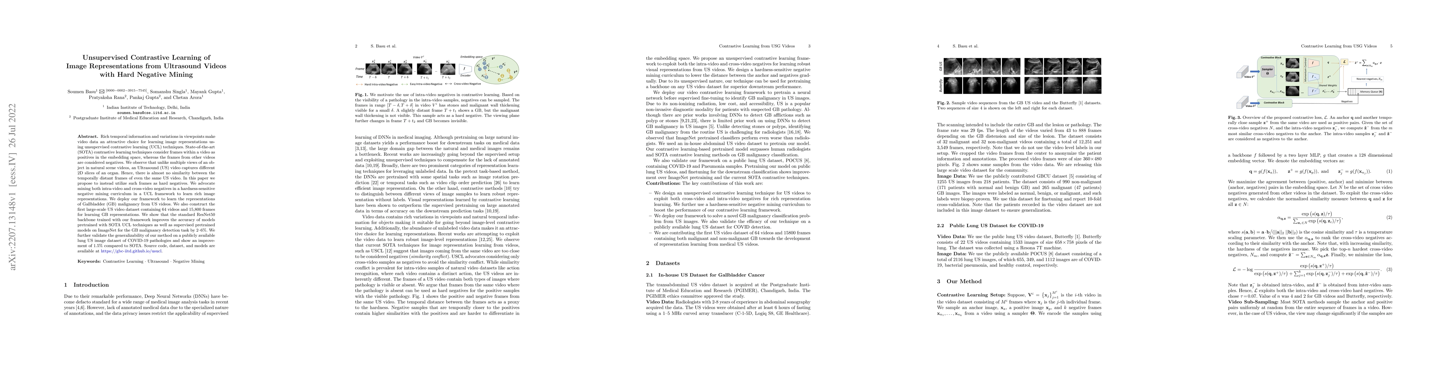 Thumbnail for Unsupervised Contrastive Learning of Image Representations from
  Ultrasound Videos with Hard Negative Mining