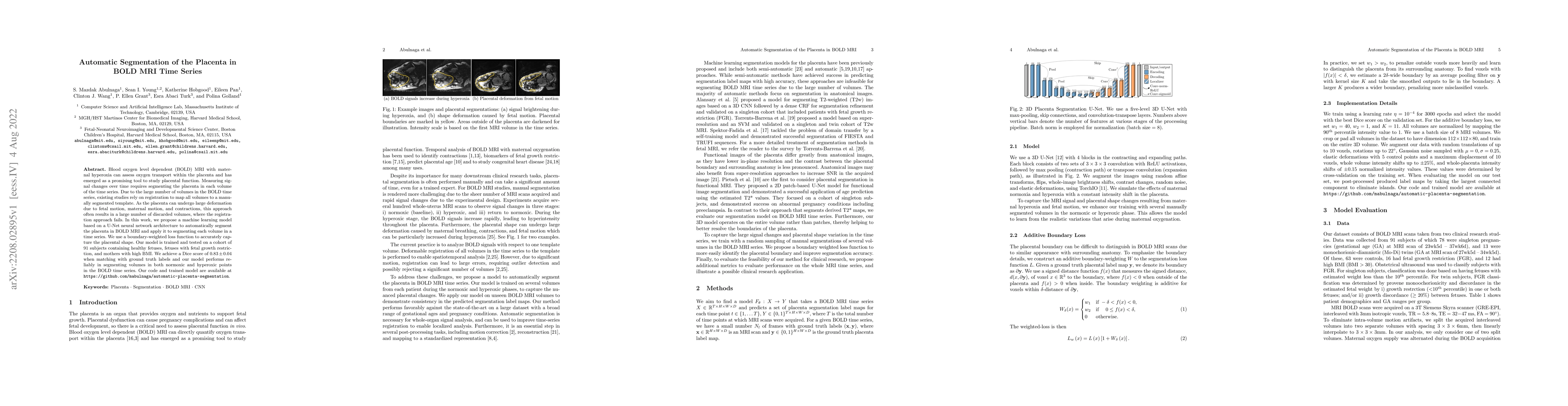 Thumbnail for Automatic Segmentation of the Placenta in BOLD MRI Time Series