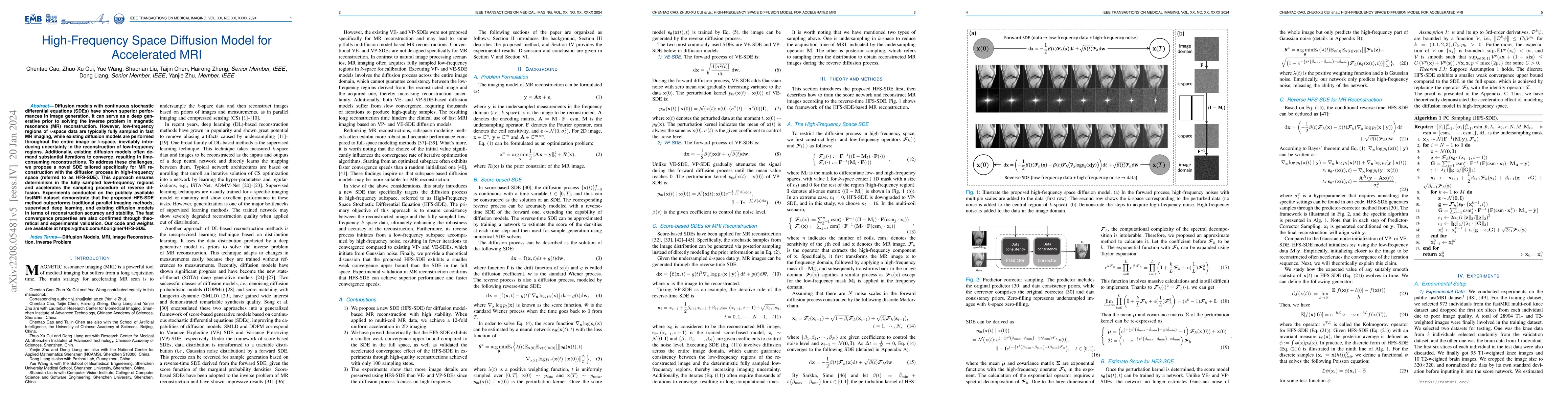 Thumbnail for High-Frequency Space Diffusion Models for Accelerated MRI