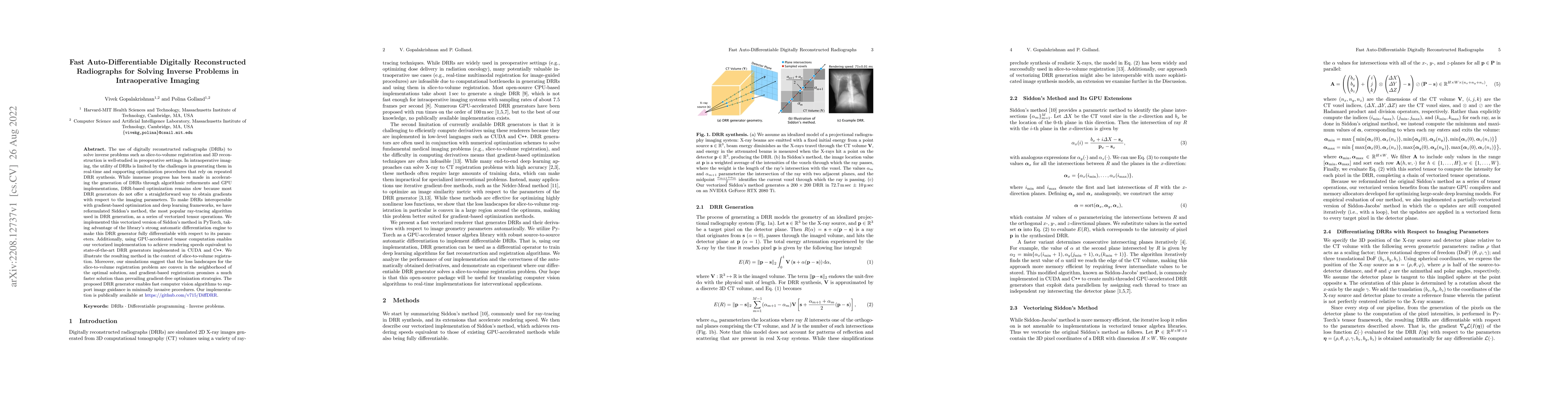Thumbnail for Fast Auto-Differentiable Digitally Reconstructed Radiographs for Solving
  Inverse Problems in Intraoperative Imaging