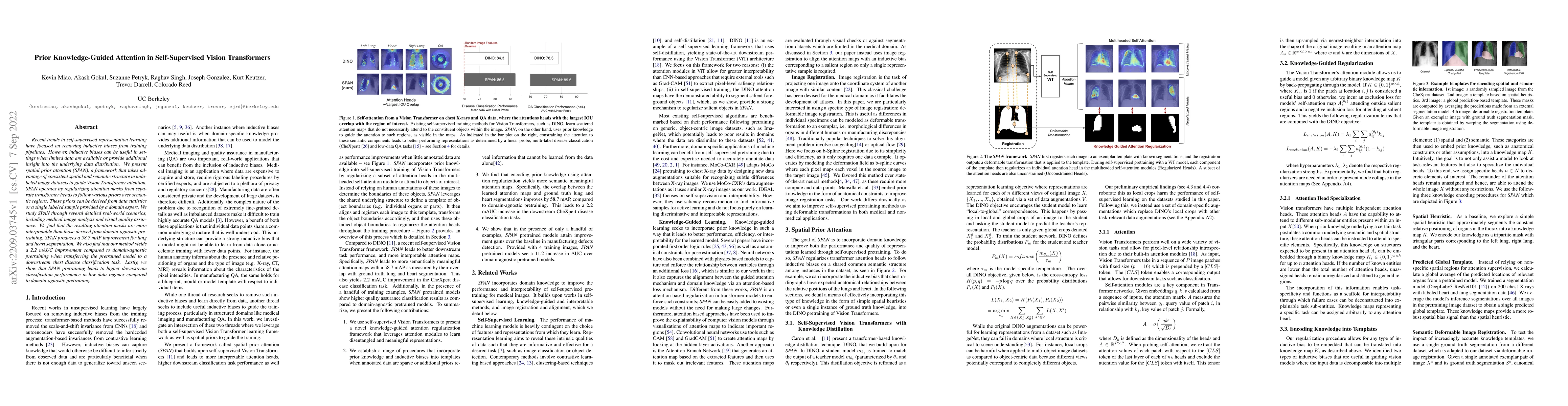Thumbnail for Prior Knowledge-Guided Attention in Self-Supervised Vision Transformers