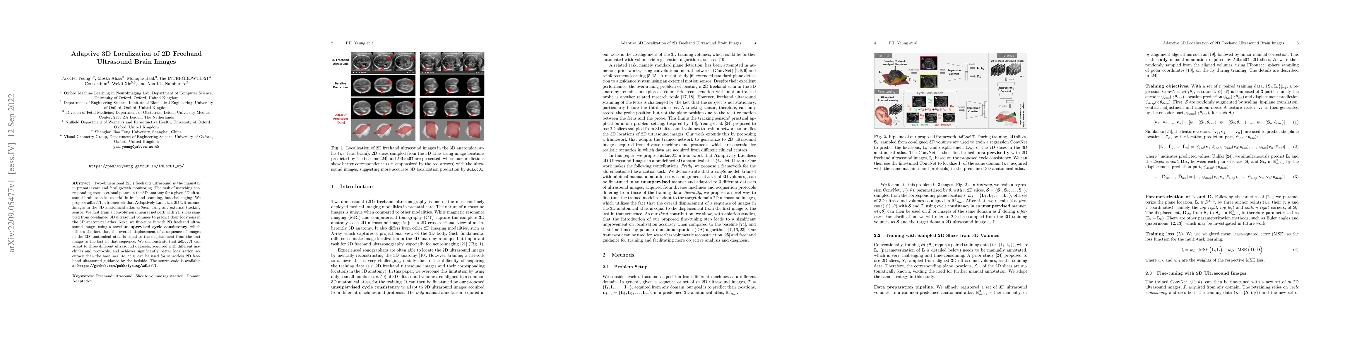 Thumbnail for Adaptive 3D Localization of 2D Freehand Ultrasound Brain Images
