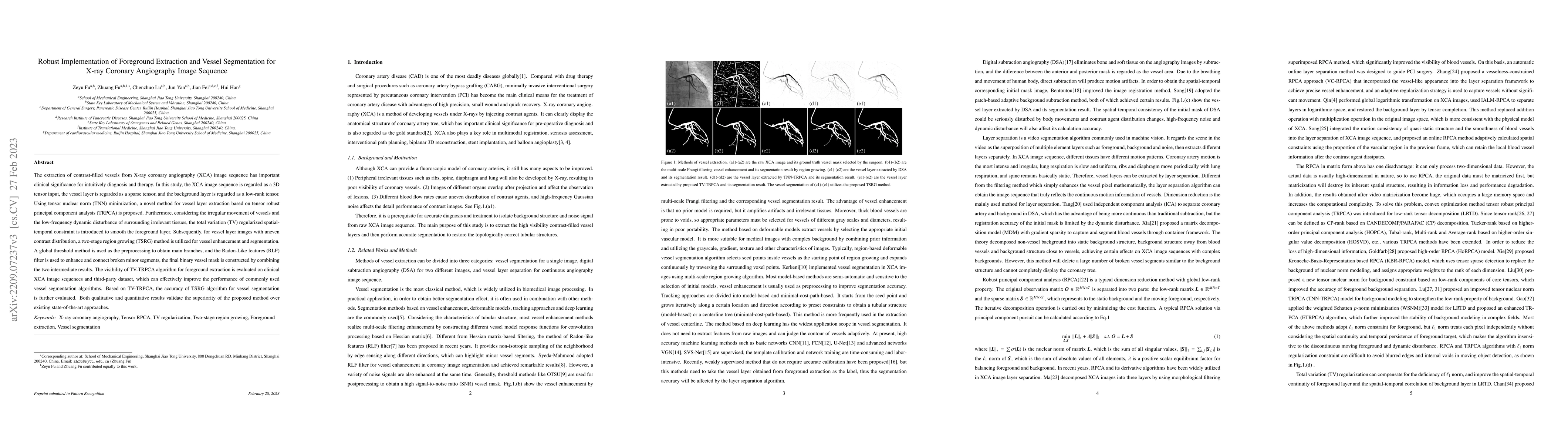 Thumbnail for Robust Implementation of Foreground Extraction and Vessel Segmentation
  for X-ray Coronary Angiography Image Sequence