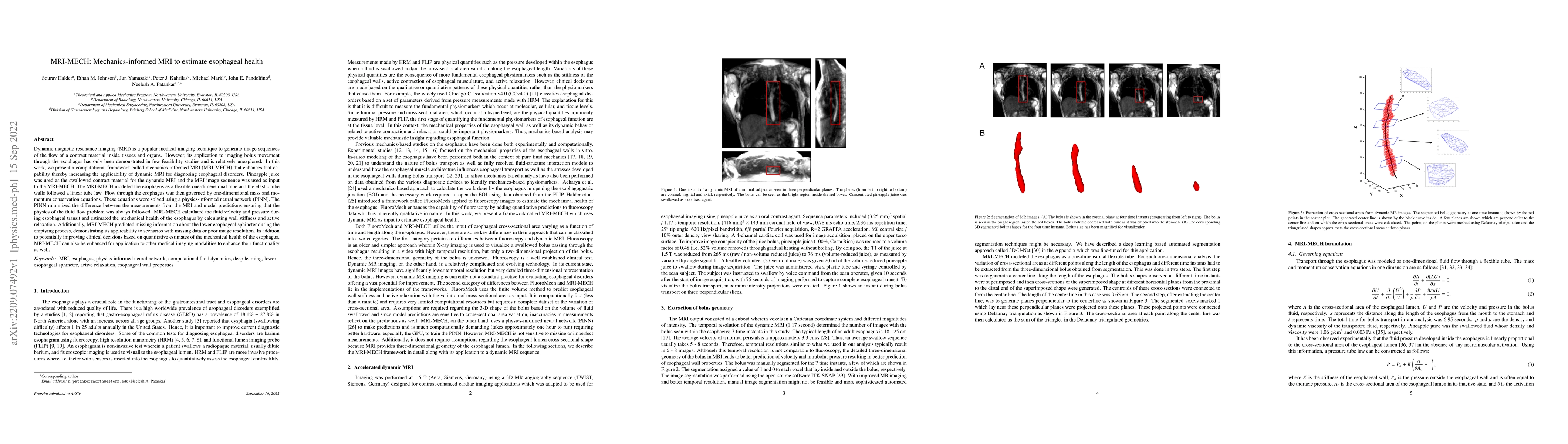 Thumbnail for MRI-MECH: Mechanics-informed MRI to estimate esophageal health