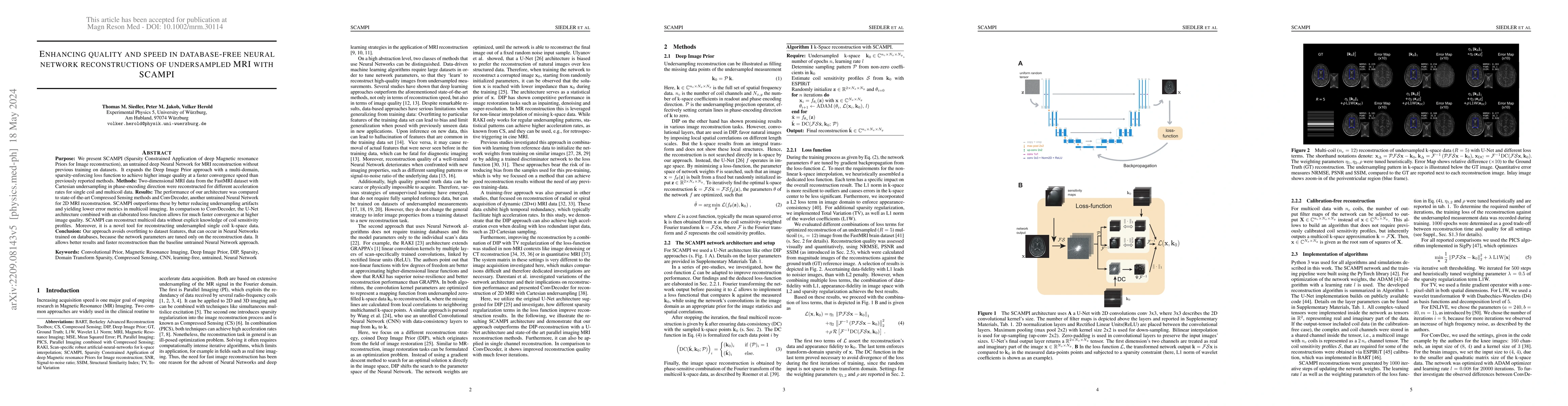 Thumbnail for Enhancing quality and speed in database-free neural network
  reconstructions of undersampled MRI with SCAMPI