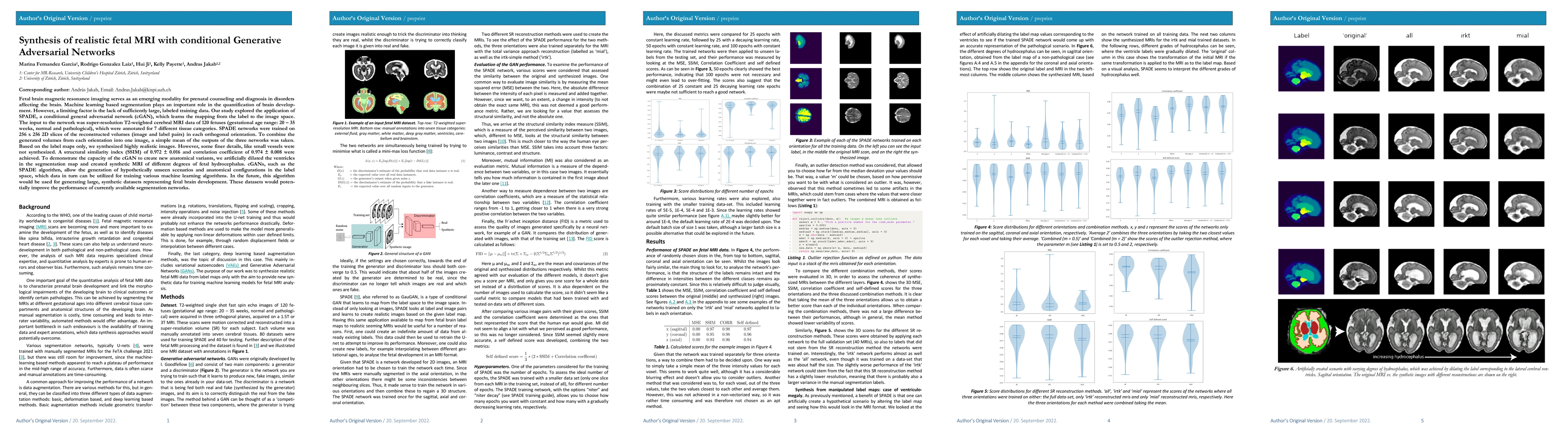 Thumbnail for Synthesis of realistic fetal MRI with conditional Generative Adversarial
  Networks