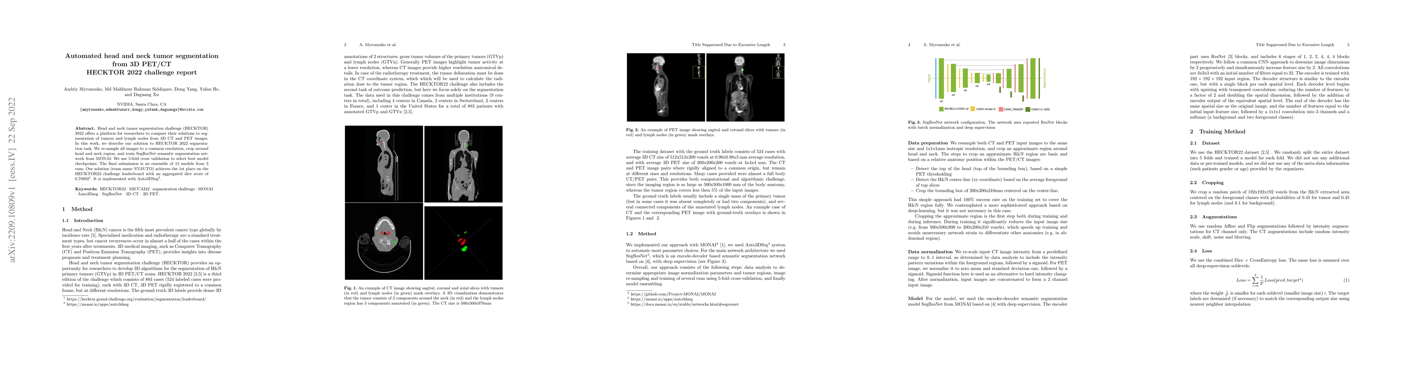 Thumbnail for Automated head and neck tumor segmentation from 3D PET/CT