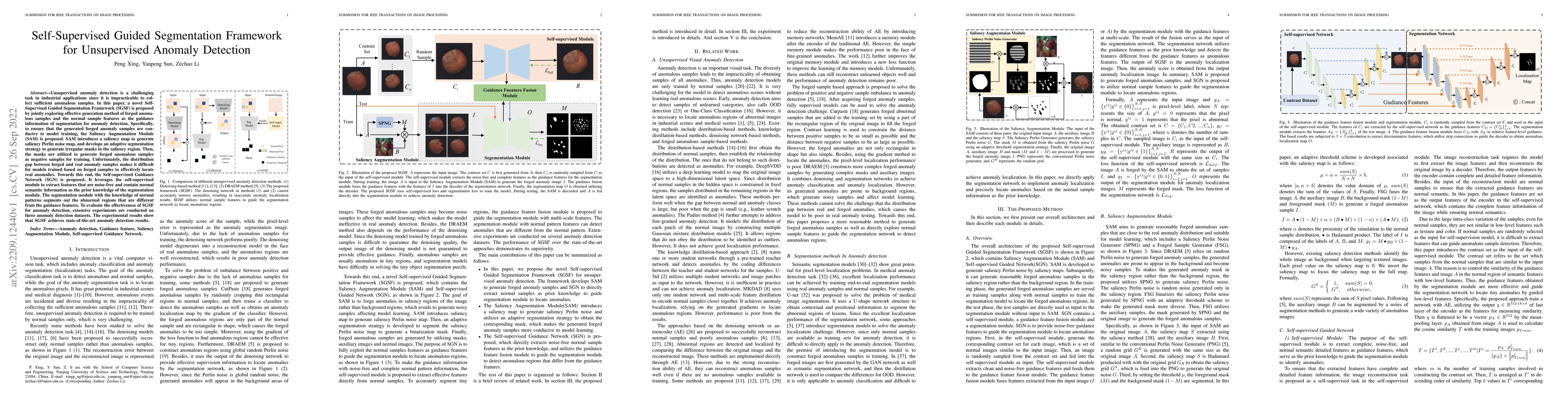 Thumbnail for Self-Supervised Guided Segmentation Framework for Unsupervised Anomaly
  Detection