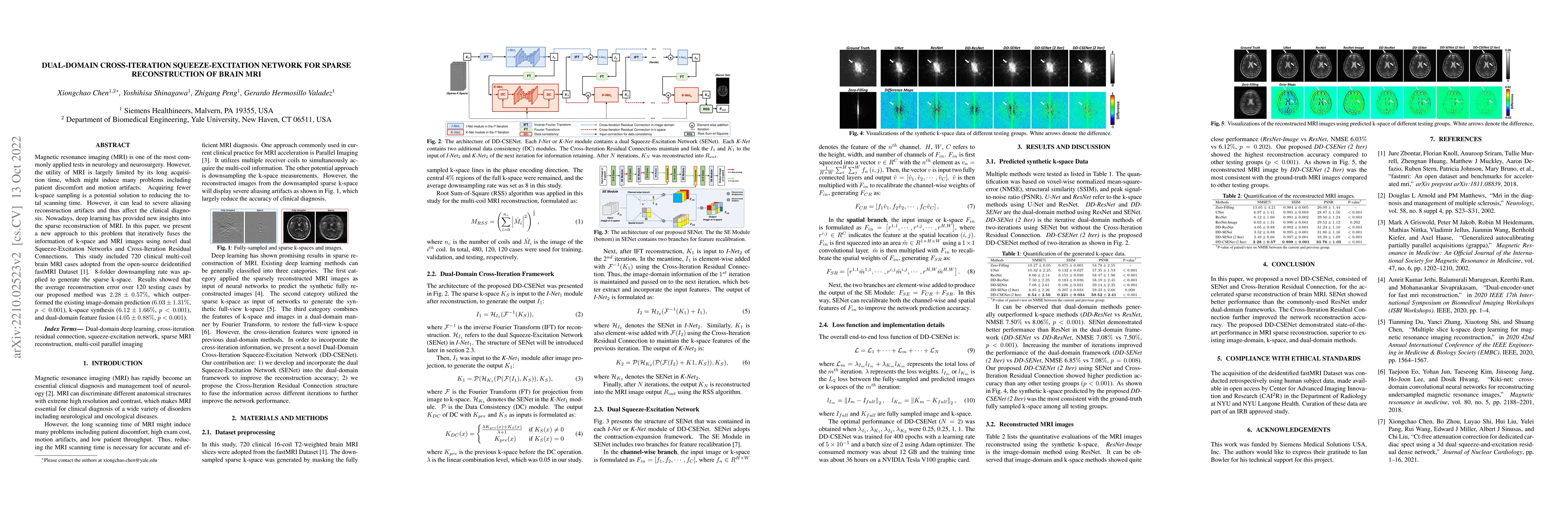 Thumbnail for Dual-Domain Cross-Iteration Squeeze-Excitation Network for Sparse
  Reconstruction of Brain MRI