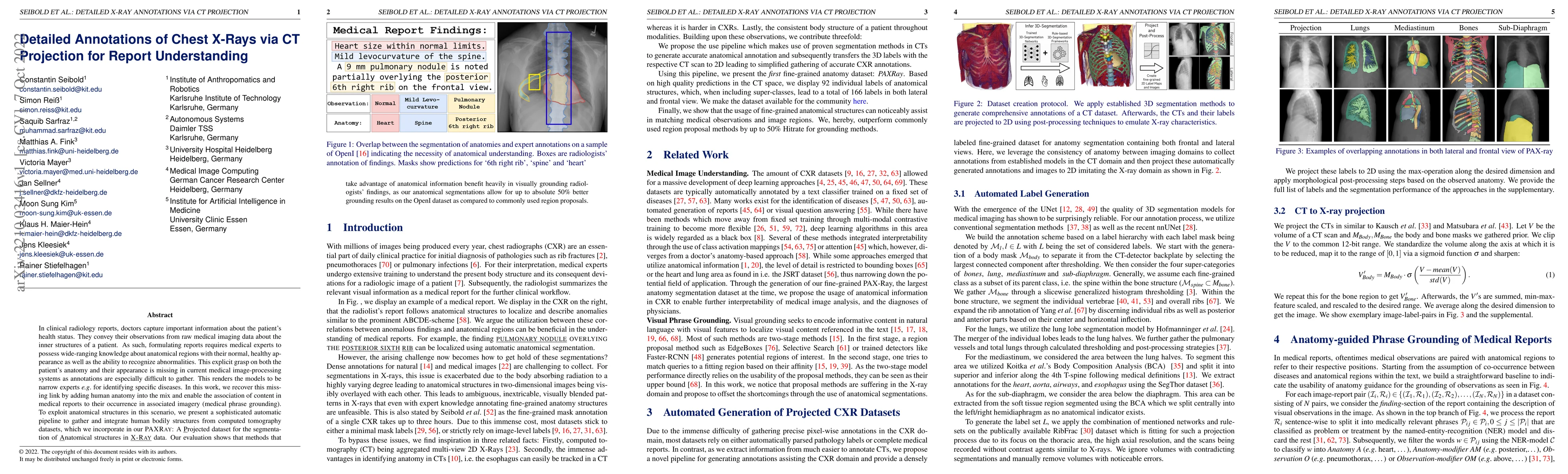 Thumbnail for Detailed Annotations of Chest X-Rays via CT Projection for Report
  Understanding