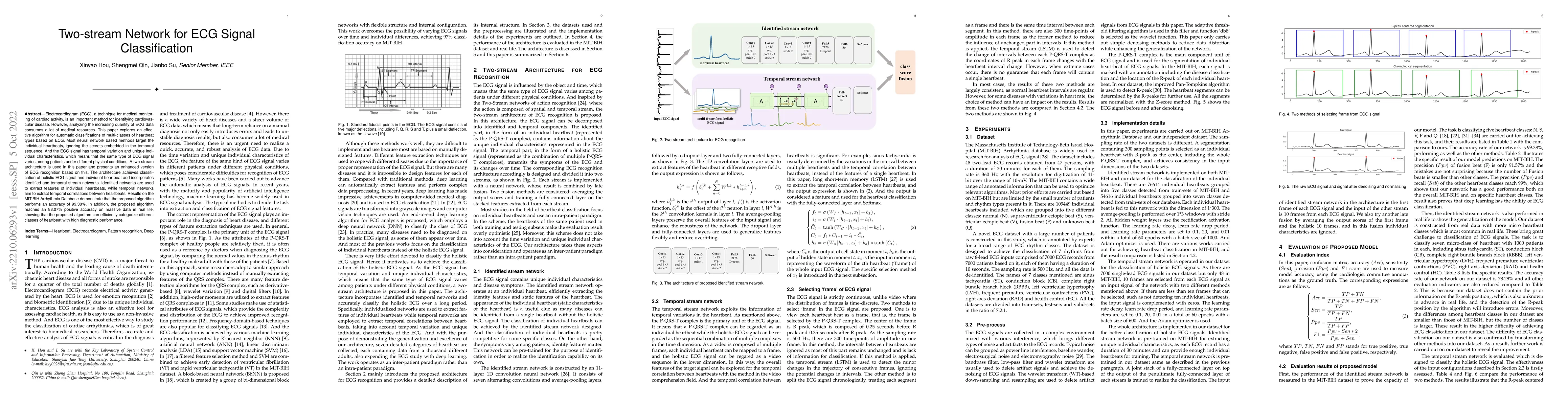 Thumbnail for Two-stream Network for ECG Signal Classification