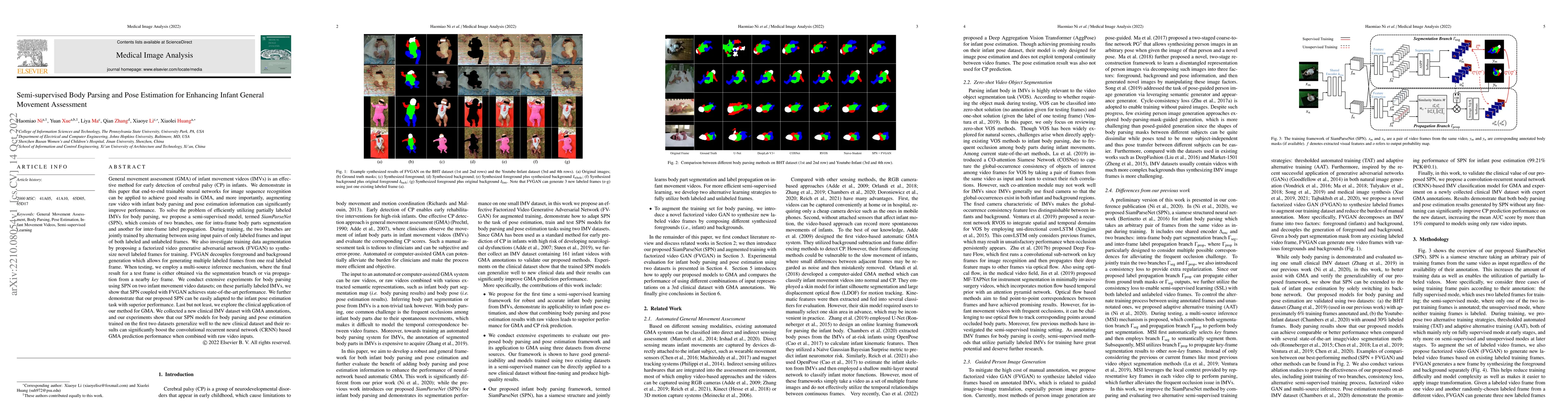 Thumbnail for Semi-supervised Body Parsing and Pose Estimation for Enhancing Infant
  General Movement Assessment