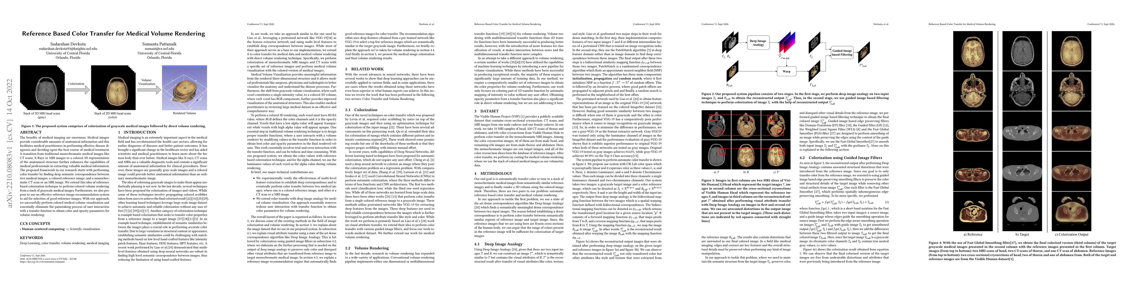 Thumbnail for Reference Based Color Transfer for Medical Volume Rendering