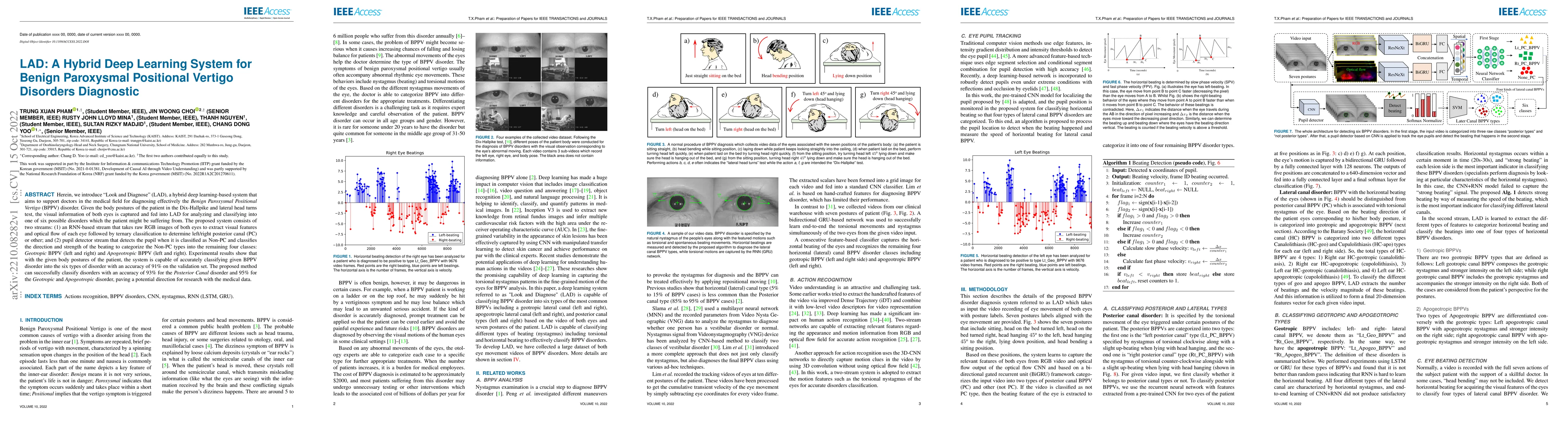 Thumbnail for LAD: A Hybrid Deep Learning System for Benign Paroxysmal Positional
  Vertigo Disorders Diagnostic