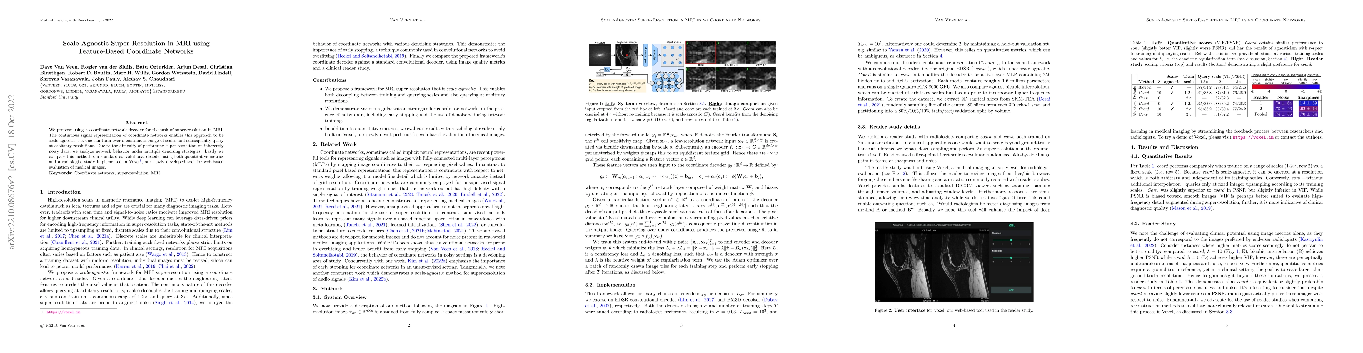 Thumbnail for Scale-Agnostic Super-Resolution in MRI using Feature-Based Coordinate
  Networks