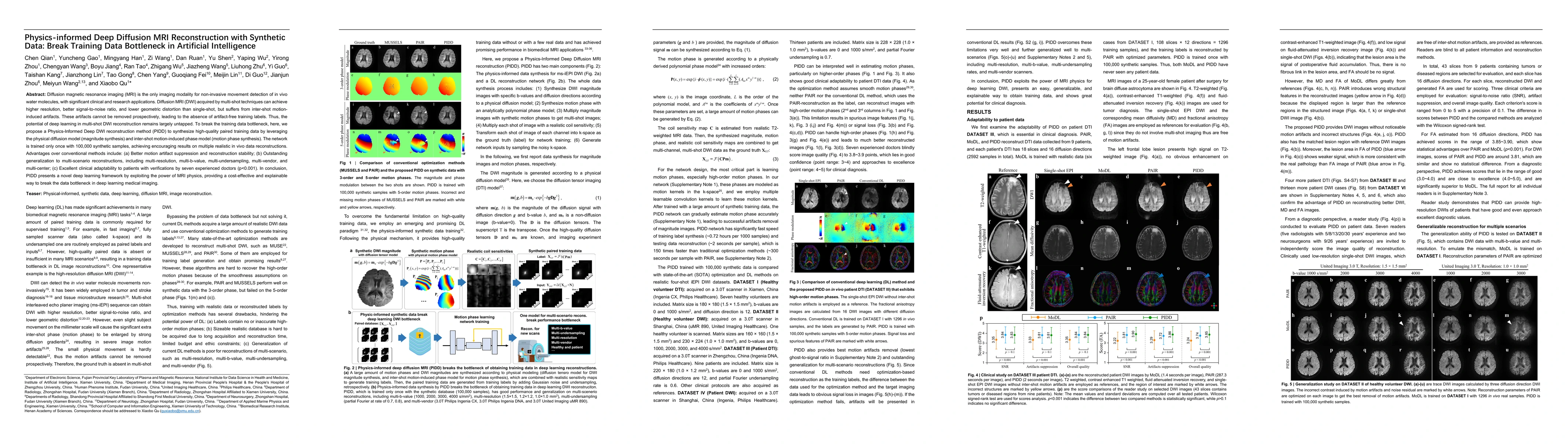 Thumbnail for Physics-informed Deep Diffusion MRI Reconstruction with Synthetic Data:
  Break Training Data Bottleneck in Artificial Intelligence