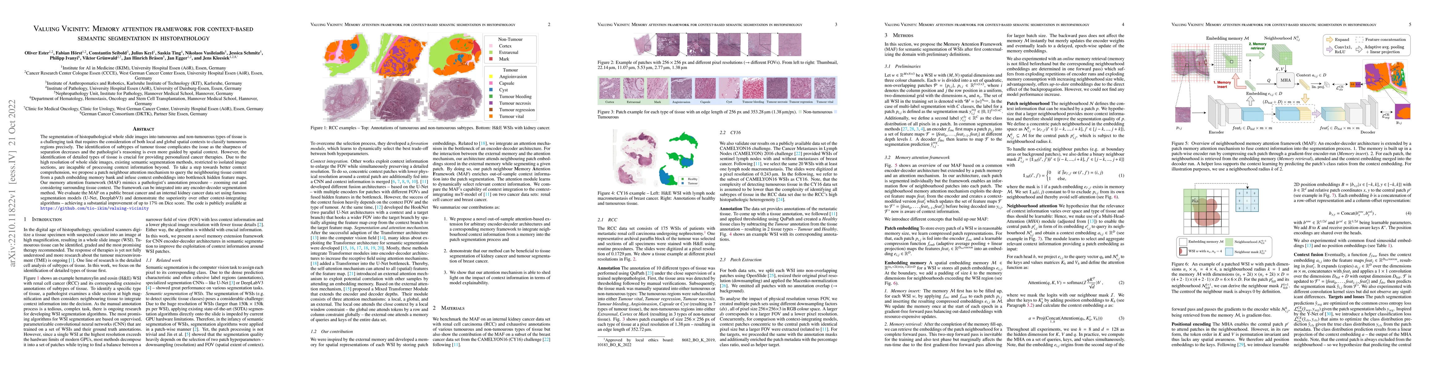 Thumbnail for Valuing Vicinity: Memory attention framework for context-based semantic
  segmentation in histopathology
