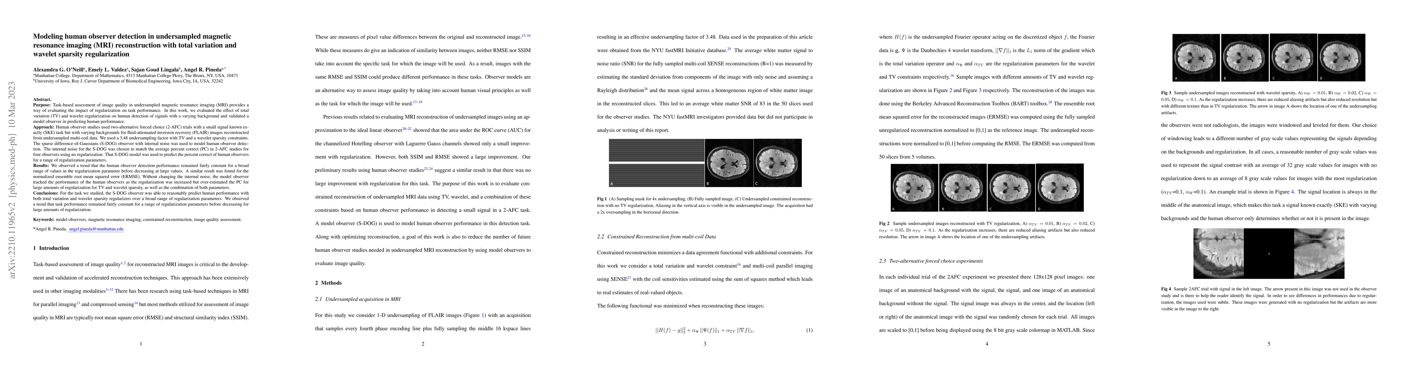 Thumbnail for Modeling human observer detection in undersampled magnetic resonance
  imaging (MRI) reconstruction with total variation and wavelet sparsity
  regularization