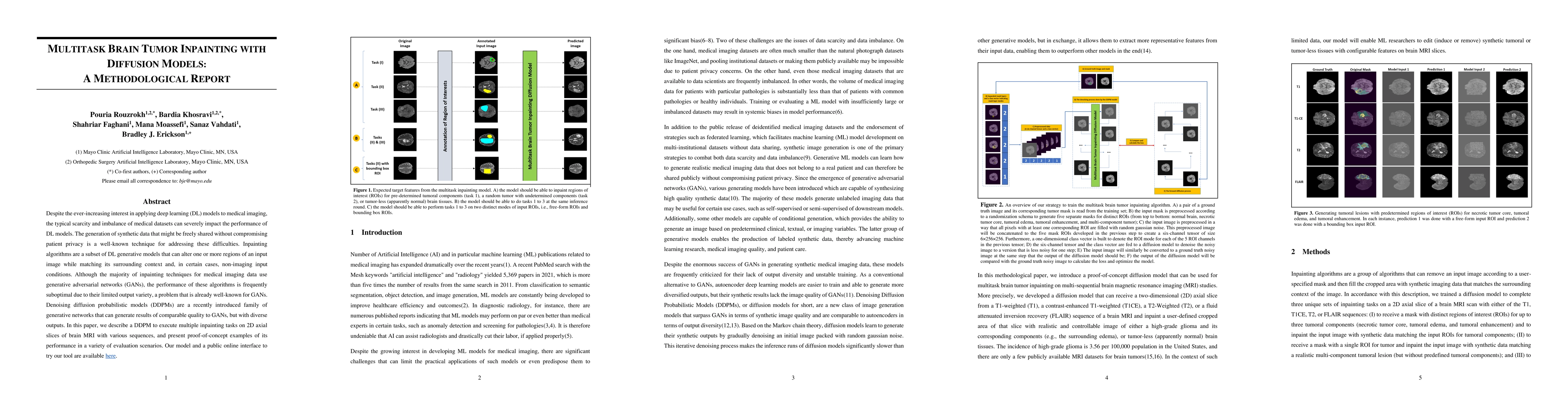 Thumbnail for Multitask Brain Tumor Inpainting with Diffusion Models: A Methodological
  Report